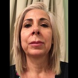 Live in care Profile - 20896
